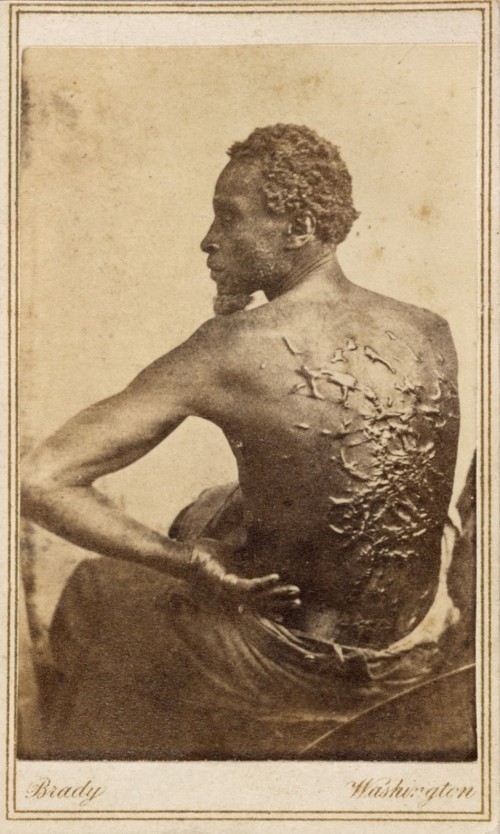 Gordon, the slave pictured here, endured terrible brutality from his master before escaping to Union Army lines in 1863. He would become a soldier and help fight to end the violent system that produced the horrendous scars on his back. Matthew Brady, Gordon, 1863. Wikimedia, http://commons.wikimedia.org/wiki/File:Gordon,_scourged_back,_NPG,_1863.jpg. 